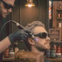 LAZER EPİLASYON (TÜM VÜCUT)